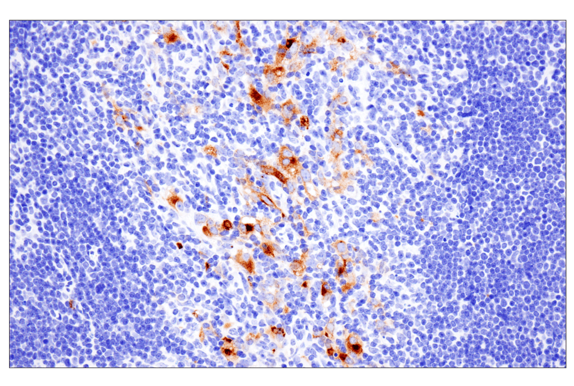 undefined Image 20: Presynaptic Vesicle Cycle Antibody Sampler Kit