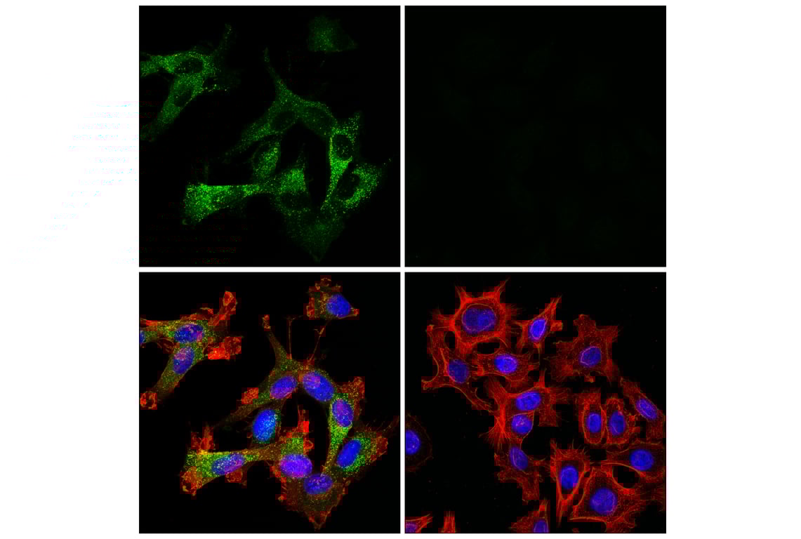 Immunofluorescence Image 1: Cathepsin L (E3R3P) Rabbit Monoclonal Antibody (BSA and Azide Free)
