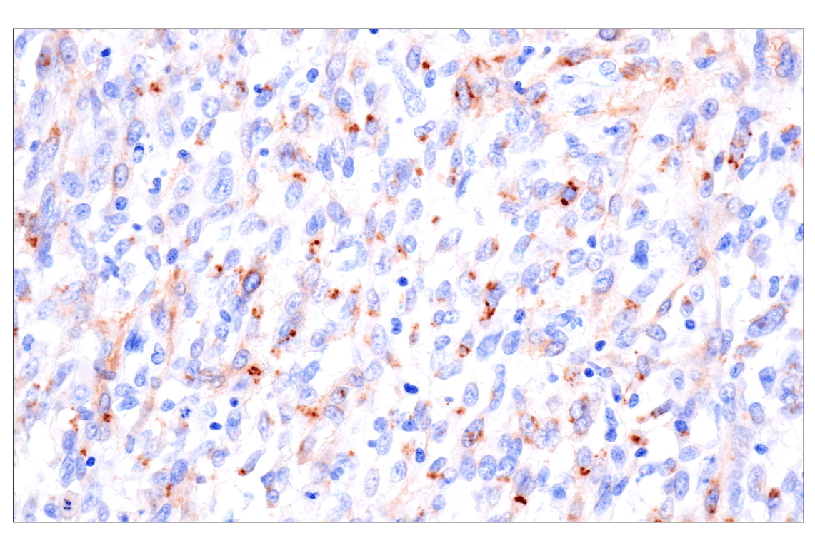 Immunohistochemistry Image 11: FAP (F1A4G) Rabbit Monoclonal Antibody