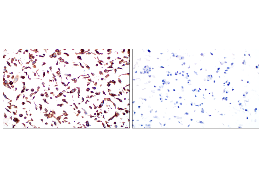 Immunohistochemistry Image 11: Glut3 (E7M7V) Rabbit Monoclonal Antibody