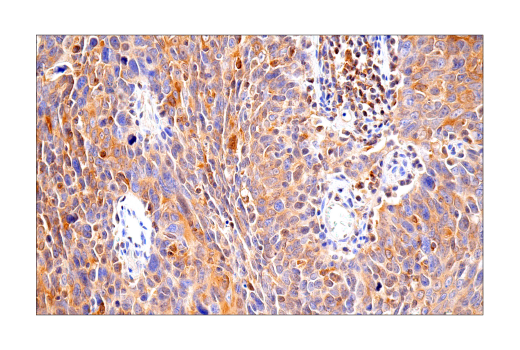 Immunohistochemistry Image 7: RIP3 (E7A7F) Rabbit Monoclonal Antibody