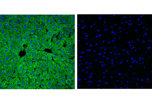 Immunofluorescence Image 1: FABP1 (D2A3X) Rabbit Monoclonal Antibody