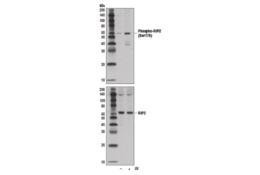 Western Blotting Image 2: Phospho-RIP2 (Ser176) (E1I9J) Rabbit mAb