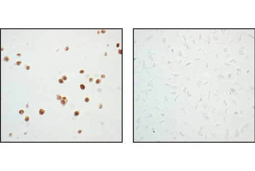 undefined Image 20: Phospho-p53 Antibody Sampler Kit