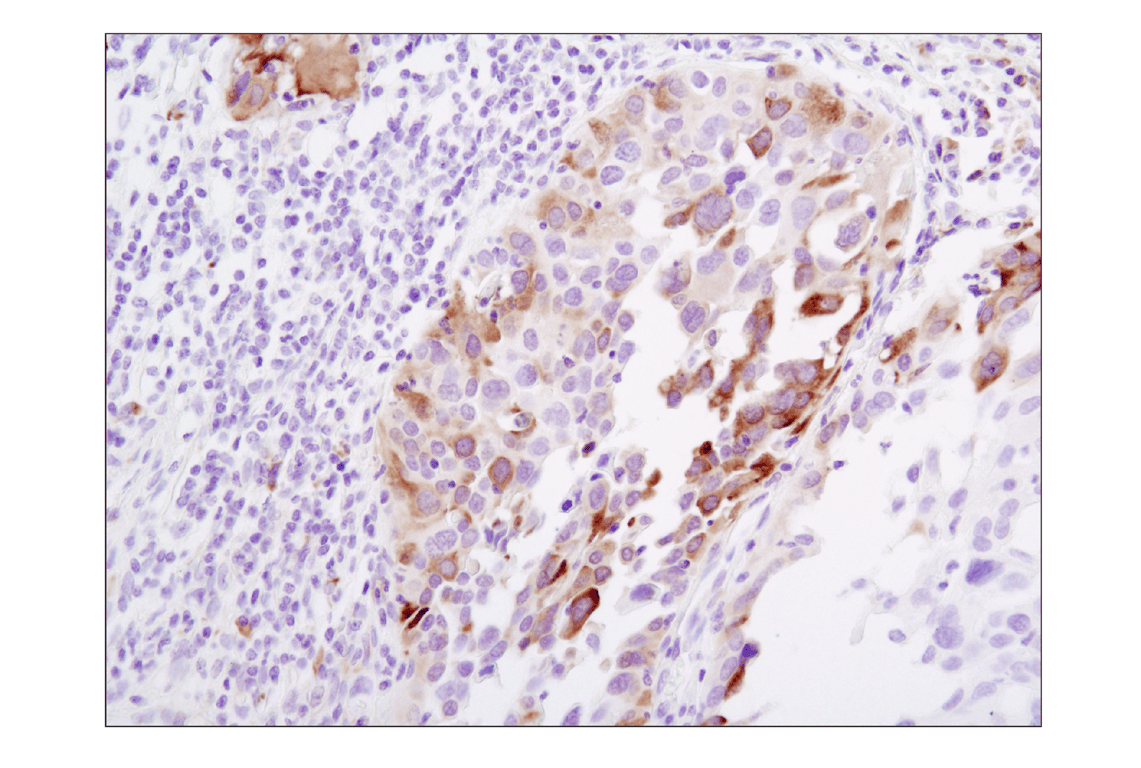 Immunohistochemistry Image 3: Phospho-S6 Ribosomal Protein (Ser235/236) (D57.2.2E) Rabbit Monoclonal Antibody