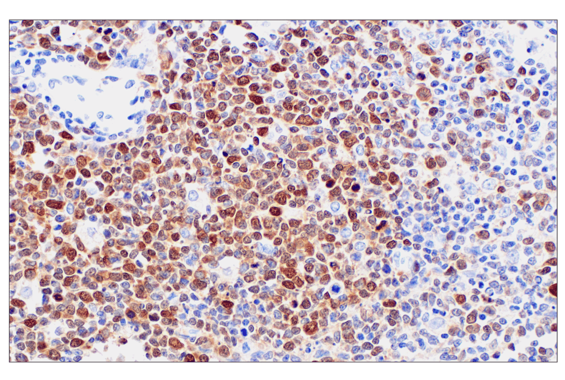 Immunohistochemistry Image 2: PBK/TOPK (F2X2Z) Rabbit Monoclonal Antibody