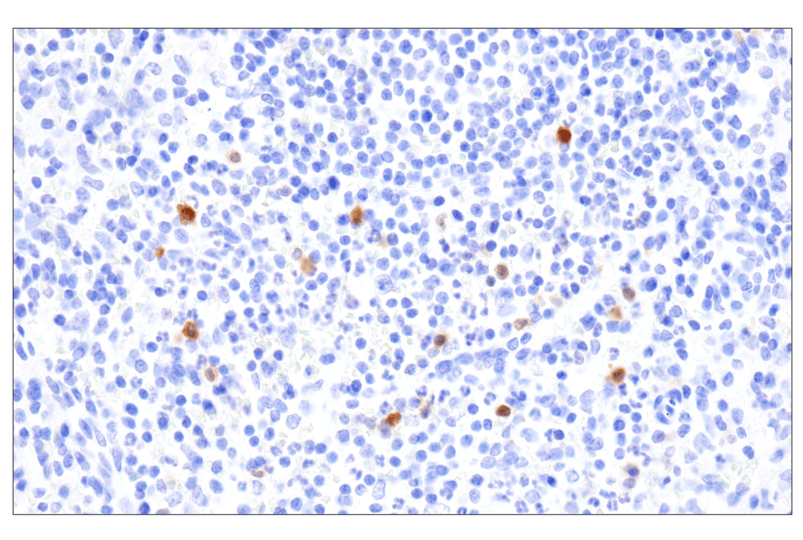 Immunohistochemistry Image 6: APOBEC3A (UMN-13) Rabbit Monoclonal Antibody (BSA and Azide Free)