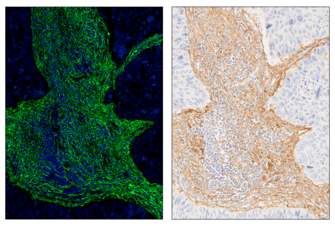 Immunohistochemistry Image 6: COL1A1 (E8F4L) & CO-0106-488 SignalStar<sup>™</sup> Oligo-Antibody Pair