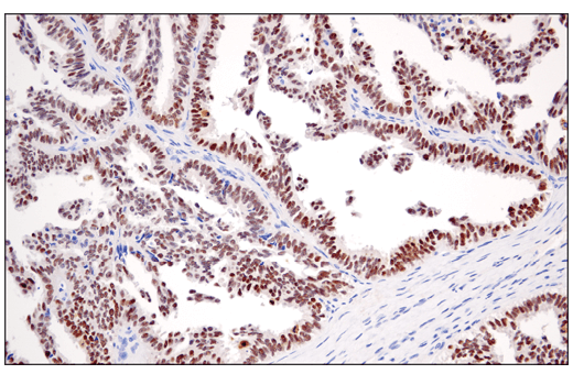 Immunohistochemistry Image 2: PRAME (E7I1B) Rabbit Monoclonal Antibody