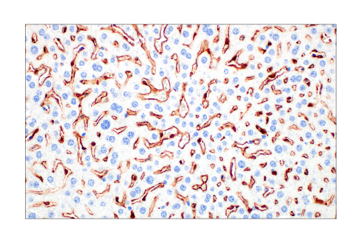 Immunohistochemistry Image 1: CD206/MRC1 (E6T5J) Rabbit Monoclonal Antibody