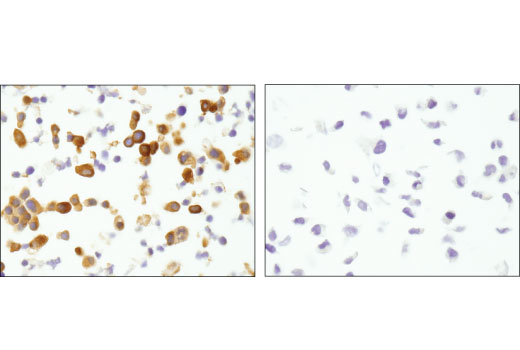 Immunohistochemistry Image 3: MTSS1 (D2H4L) Rabbit Monoclonal Antibody