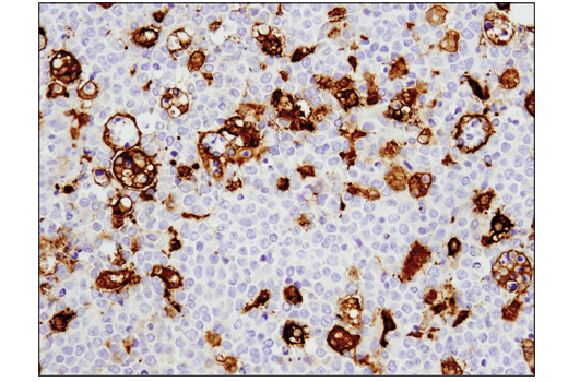 Immunohistochemistry Image 2: GLUL (D2O3F) Rabbit Monoclonal Antibody (IHC Formulated)