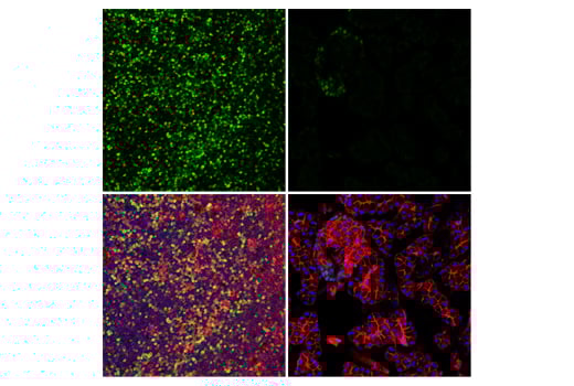 Immunofluorescence Image 2: Tox/Tox2 (E6G5O) Rabbit Monoclonal Antibody (BSA and Azide Free)