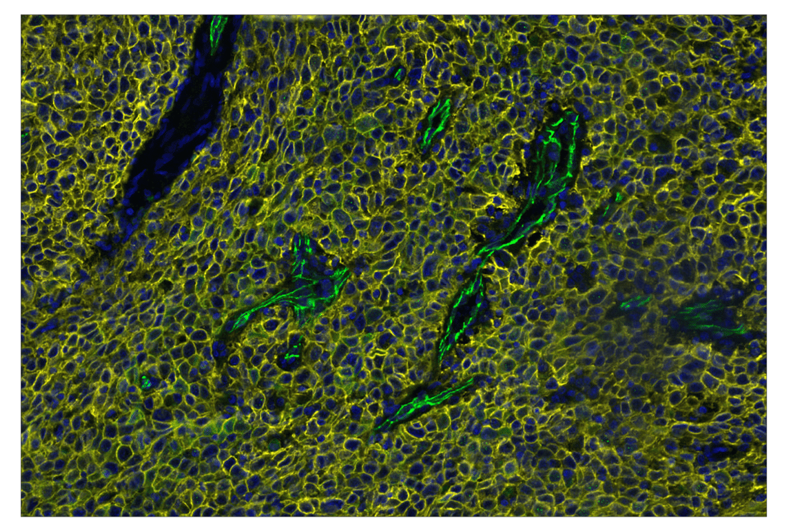 Immunohistochemistry Image 3: VE-Cadherin (E6N7A) & CO-0149-647 SignalStar<sup>™</sup> Oligo-Antibody Pair
