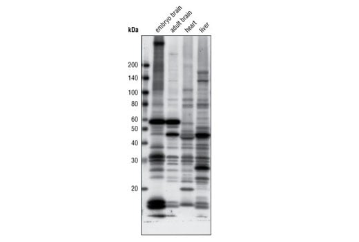 Western Blotting Image 2: Acetylated-Lysine (Ac-K<sup>2</sup>-100) MultiMab<sup>®</sup> Rabbit Monoclonal Antibody mix
