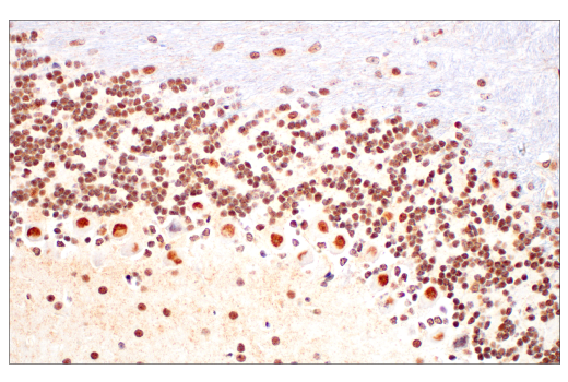 Immunohistochemistry Image 5: Ezh2 (D2C9) Rabbit Monoclonal Antibody (BSA and Azide Free)