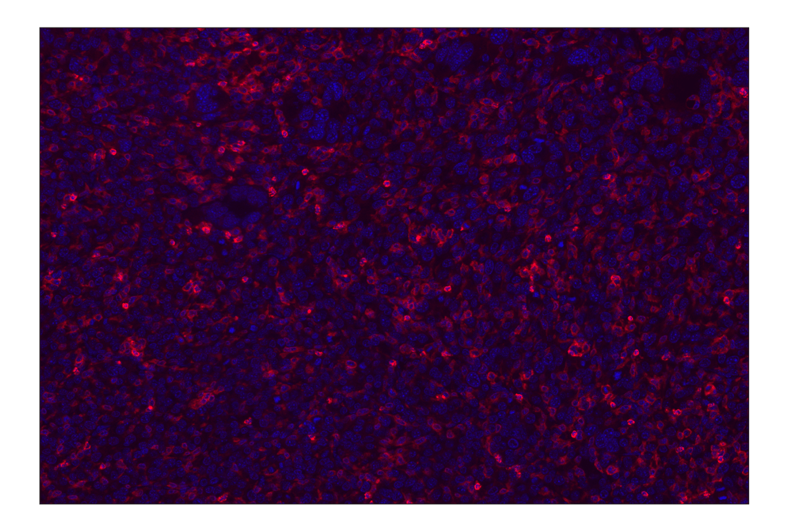 Immunohistochemistry Image 2: CD11b/ITGAM (E4K8C) Rabbit Monoclonal Antibody (Alexa Fluor<sup>®</sup> 647 Conjugate)
