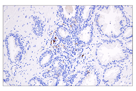 Immunohistochemistry Image 5: Cleaved Gasdermin D (Asp275) (E7H9G) Rabbit Monoclonal Antibody
