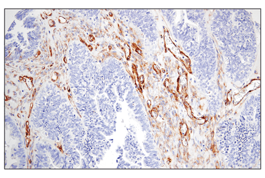 Immunohistochemistry Image 5: IGFBP7 (E3Z8L) Rabbit Monoclonal Antibody