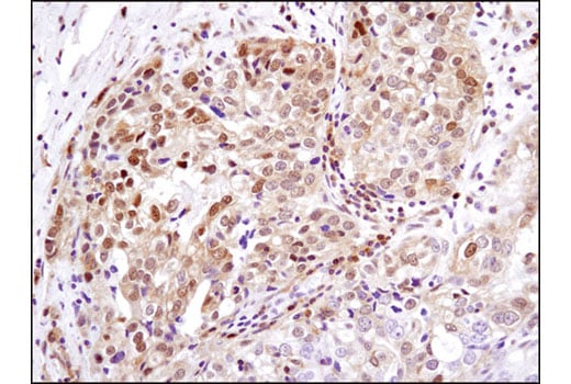 Phospho-Erk1/2 Pathway Antibody Sampler Kit | Cell Signaling