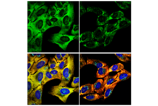 Immunofluorescence Image 2: YTHDF2 (E2I2H) Rabbit Monoclonal Antibody