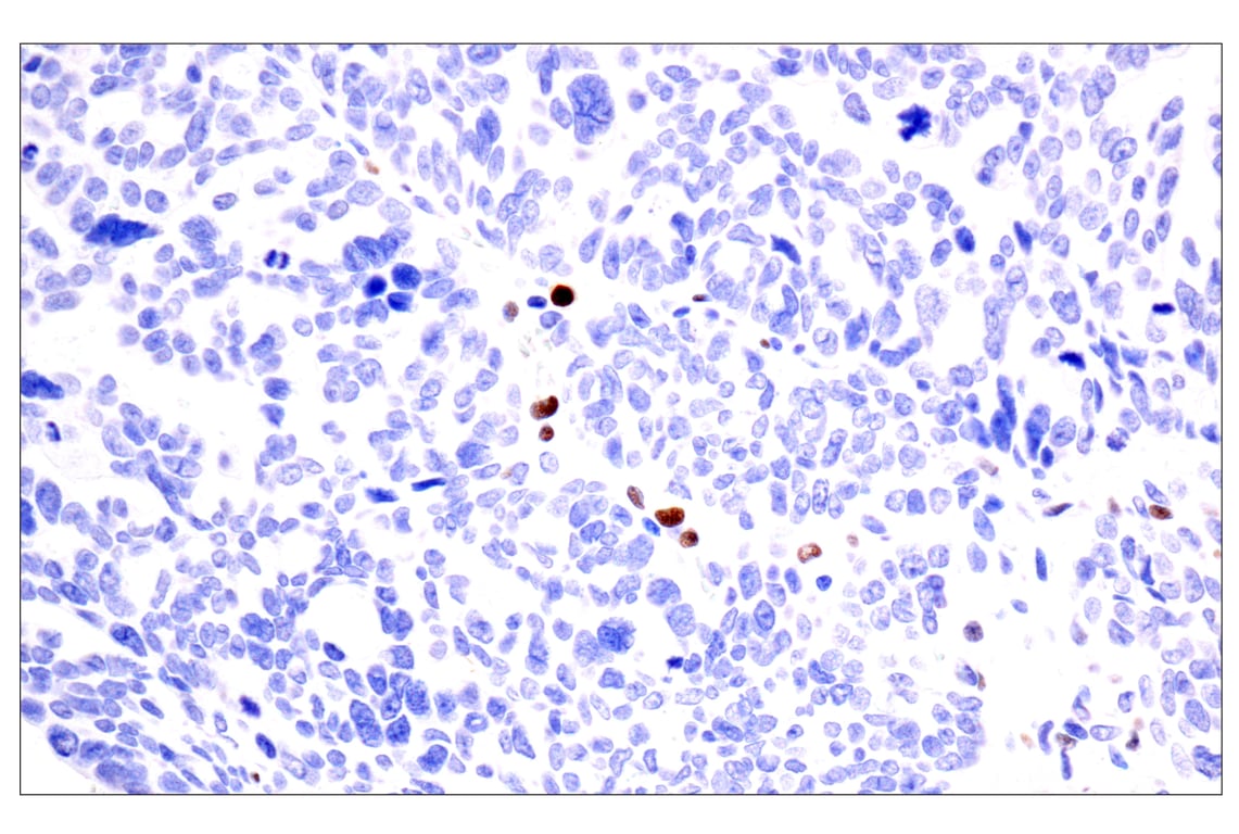 Immunohistochemistry Image 4: BATF3 (E3F3L) Rabbit Monoclonal Antibody