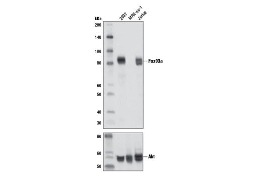 undefined Image 1: Forkhead Signaling Antibody Sampler Kit