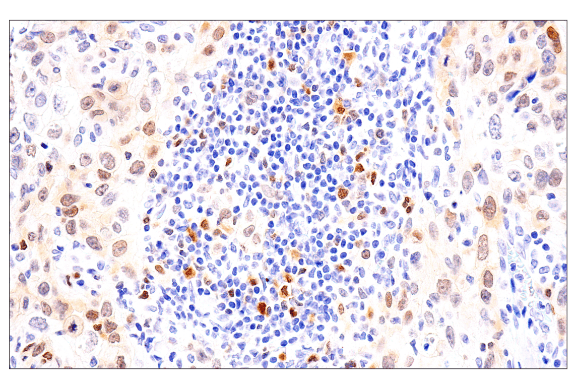 undefined Image 6: Phospho-Chk1/2 Antibody Sampler Kit