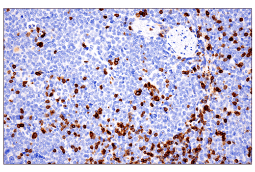 Immunohistochemistry Image 2: CD3 epsilon (E4T1B) Rabbit Monoclonal Antibody