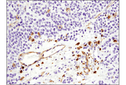 Immunohistochemistry Image 3: VISTA (D1L2G) Rabbit Monoclonal Antibody (BSA and Azide Free)