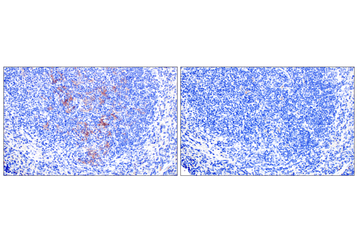 Immunohistochemistry Image 6: Dectin-1/ Clec7a (E3P5W) Rabbit Monoclonal Antibody