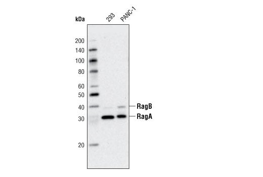 Western Blotting Image 1: RagA (D8B5) Rabbit mAb