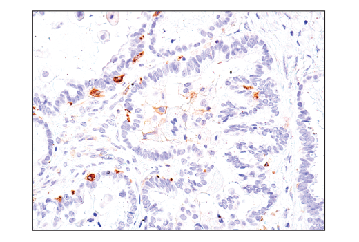 Immunohistochemistry Image 4: Axl (C89E7) Rabbit Monoclonal Antibody