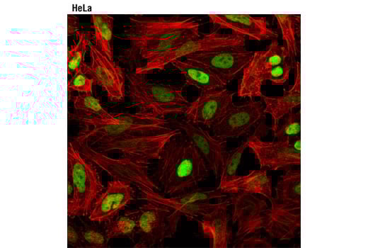 Immunofluorescence Image 1: Topoisomerase II alpha (D10G9) Rabbit Monoclonal Antibody