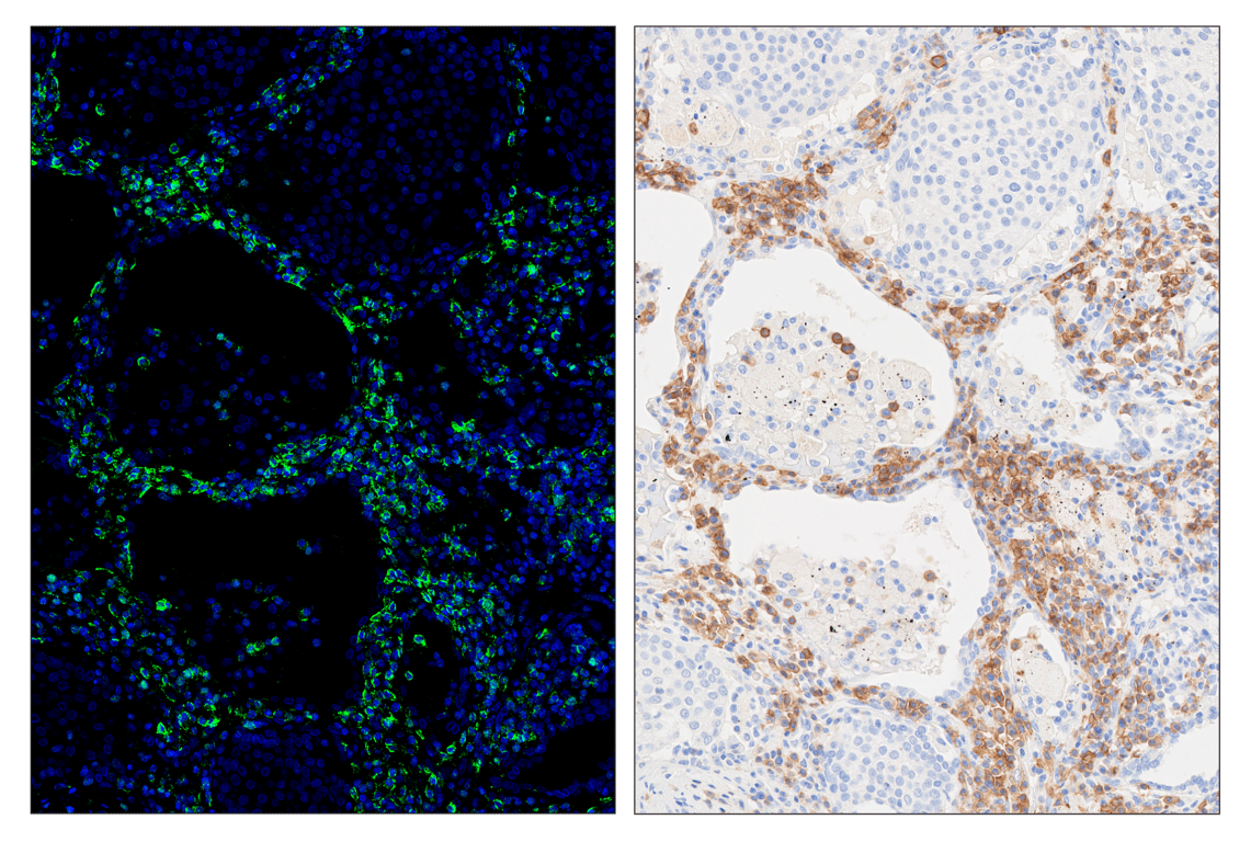 Immunohistochemistry Image 5: CD19 (Intracellular Domain) (D4V4B) & CO-0054-750 SignalStar<sup>™</sup> Oligo-Antibody Pair