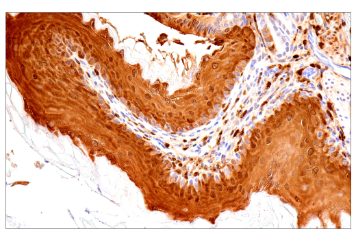 Immunohistochemistry Image 5: Galectin-3/LGALS3 (E7B6R) Rabbit Monoclonal Antibody