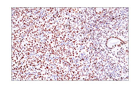 Immunohistochemistry Image 4: 53BP1 (E7N5D) XP<sup>®</sup> Rabbit mAb