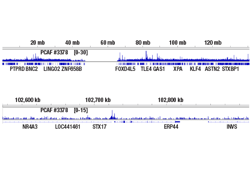 undefined Image 10: Lysine Acetyltransferase Antibody Sampler Kit