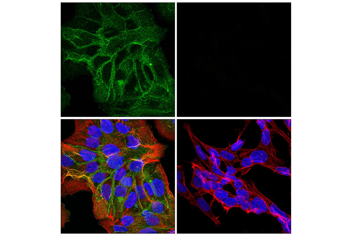 Immunofluorescence Image 1: Syndecan 1 (E7S6T) Rabbit Monoclonal Antibody