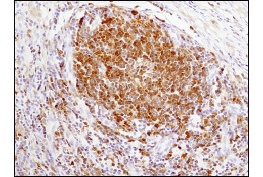 Immunohistochemistry Image 3: Syk (D3Z1E) Rabbit Monoclonal Antibody (BSA and Azide Free)