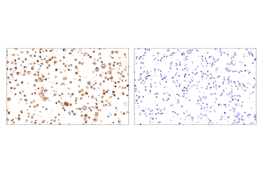 Immunohistochemistry Image 2: Iba1/AIF-1 (E5N4J) Mouse Monoclonal Antibody (BSA and Azide Free)