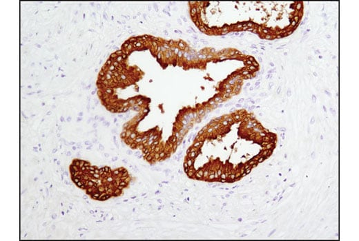 Immunohistochemistry Image 1: Prostatic Acid Phosphatase (D3Y5P) Rabbit Monoclonal Antibody (BSA and Azide Free)