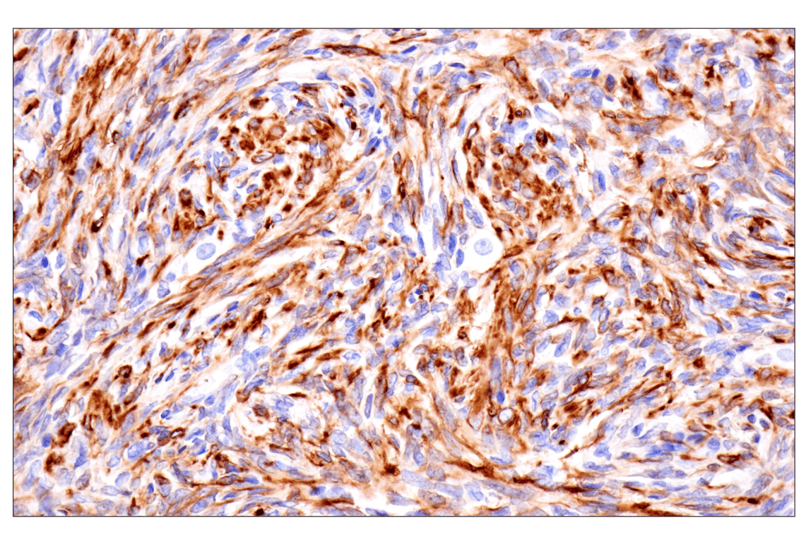 Immunohistochemistry Image 9: Desmin (F5V4I) Rabbit Monoclonal Antibody (BSA and Azide Free)
