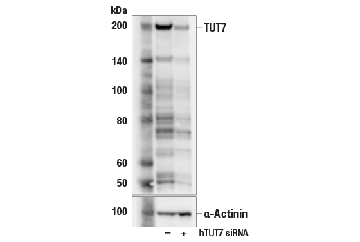 Western Blotting Image 2: TUT7 (E1R7Y) Rabbit Monoclonal Antibody