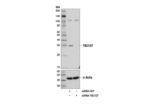 Western Blotting Image 2: TBC1D7 (D8K1Y) Rabbit Monoclonal Antibody