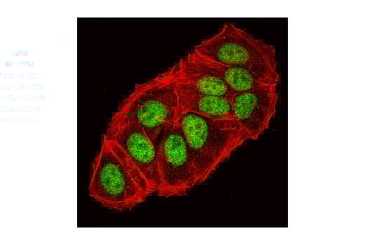 Immunofluorescence Image 1: HIF-1 beta/ARNT (C15A11) Rabbit Monoclonal Antibody