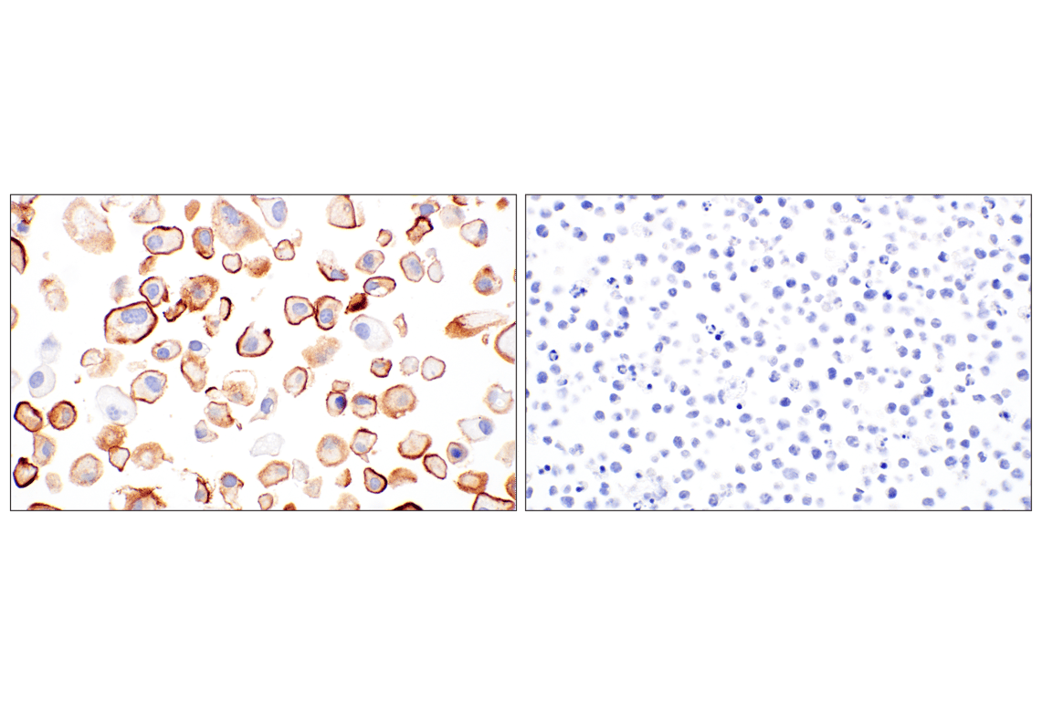 Immunohistochemistry Image 4: UPK3B (DBRRM3.66) Rabbit Monoclonal Antibody