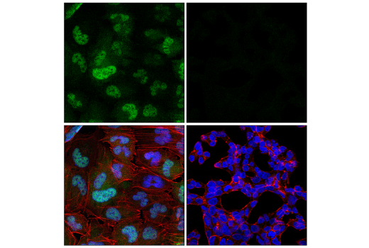 Immunofluorescence Image 1: CDK6 (D4S8S) Rabbit Monoclonal Antibody