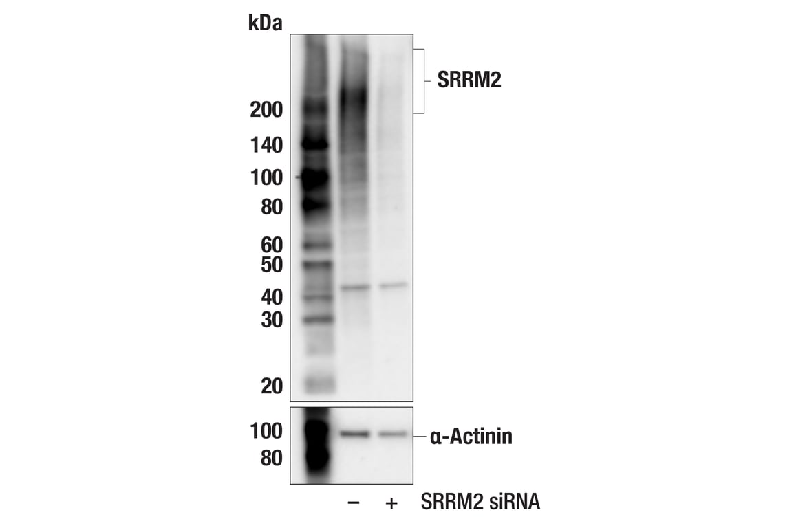 Western Blotting Image 2: SRRM2 (F3J1Z) Rabbit Monoclonal Antibody