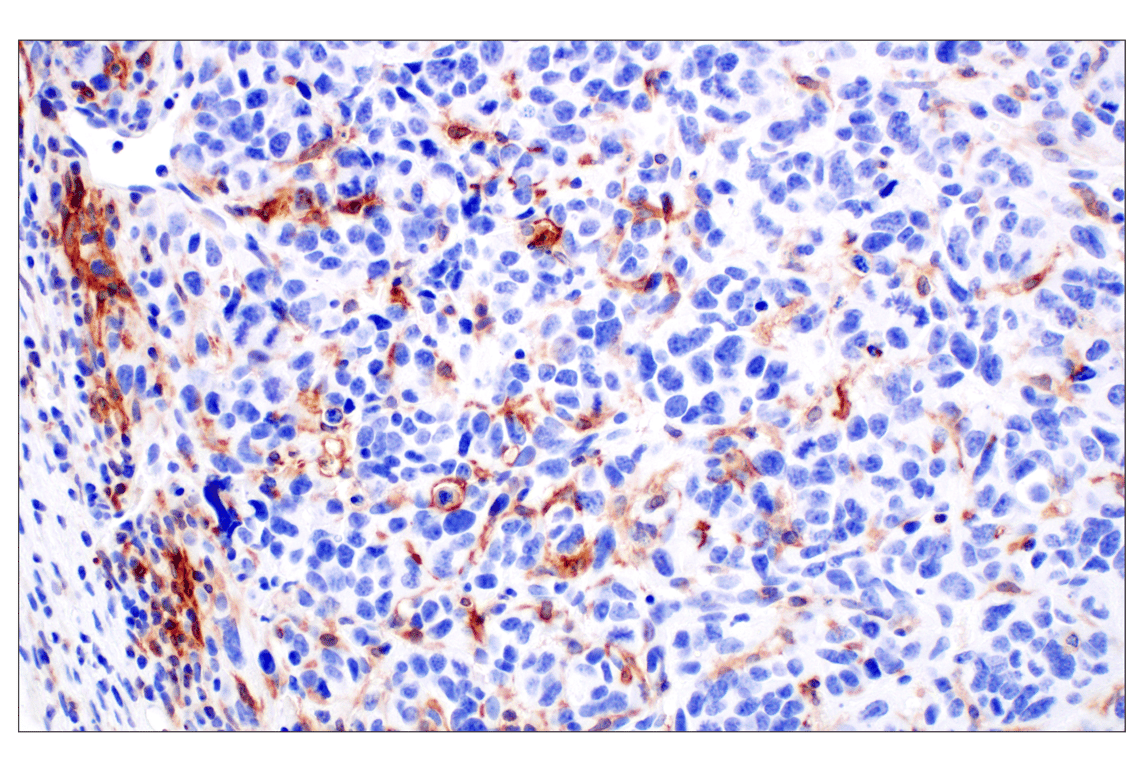 Immunohistochemistry Image 3: Dectin-1/ Clec7a (E3P5W) Rabbit Monoclonal Antibody